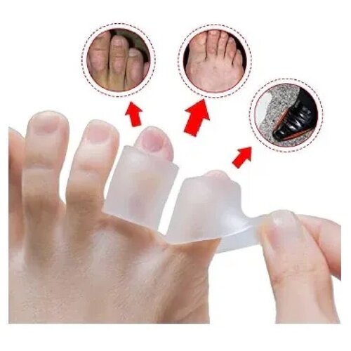 ������ ������ �������� �� ������� ����� (����) ����