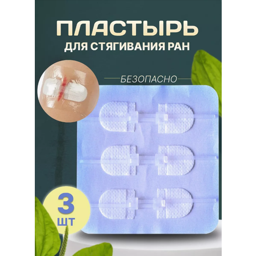 ������ ������ �������� ��� ���������� ��� 3 ��. ����� 90mm?20mm ����